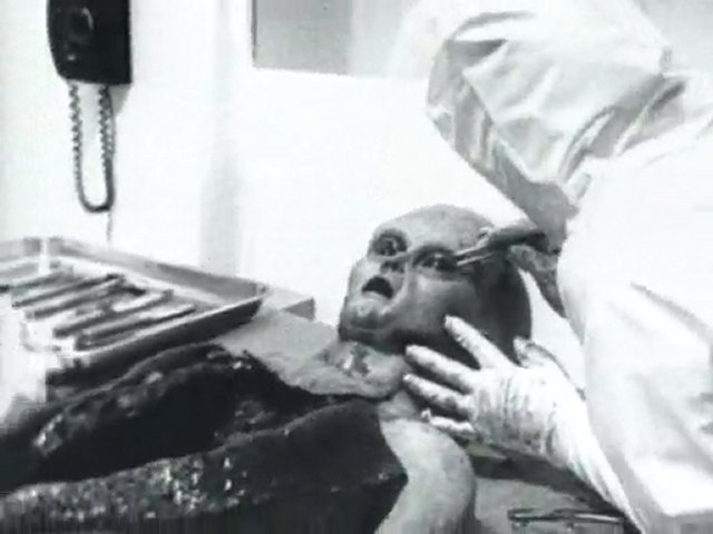 The infamous Alien Autopsy