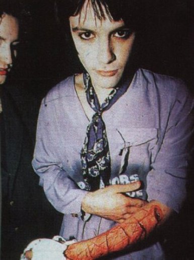 Richey Edwards, with '4 REAL' carved into his arm